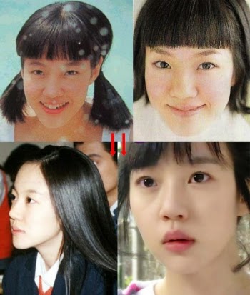 Uk Celebrity Gossip New Magazine ~ : Korean Actresses Plastic Surgery