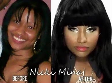 Nicki minaj before plastic surgeries agree, remarkable Nicki minaj before plastic surgeries