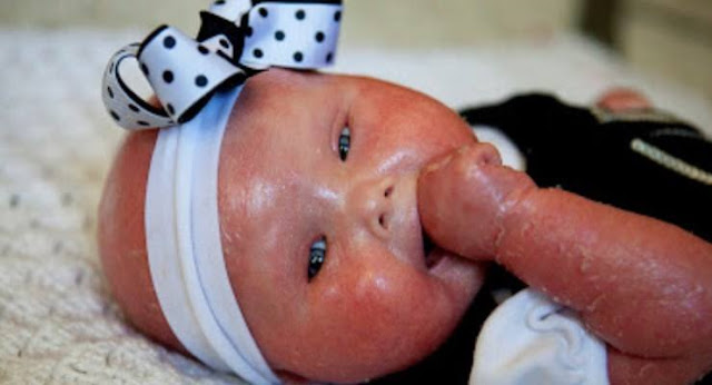 5 Bayi Aneh Bin Ajaib Yang Lahir di Dunia 5 Bayi Aneh Bin Ajaib Yang Lahir di Dunia