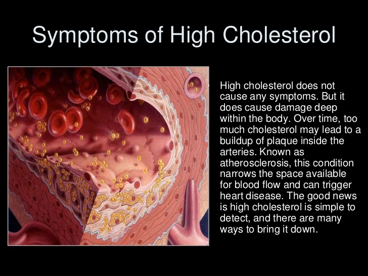 High cholesterol