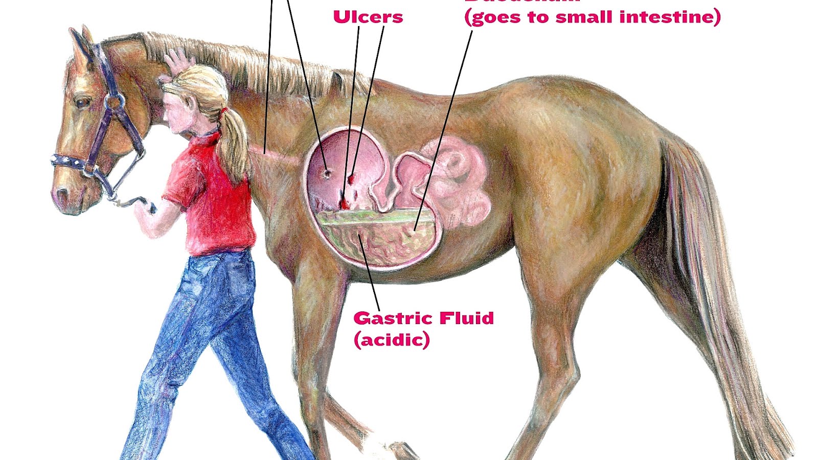Equine gastric ulcer syndrome Ulcer Choices