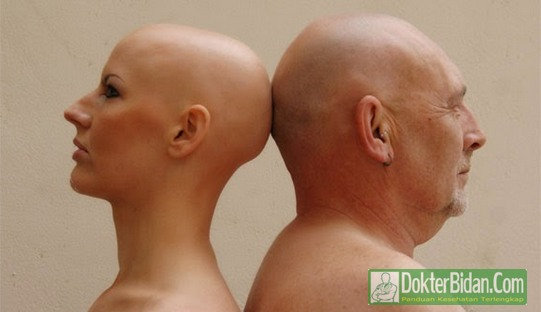Botak - Penyebab Gejala Diagnosis dan Cara Menumbuhkan Rambut Dengan Cepat Botak - Penyebab Gejala Diagnosis dan Cara Menumbuhkan Rambut Dengan Cepat