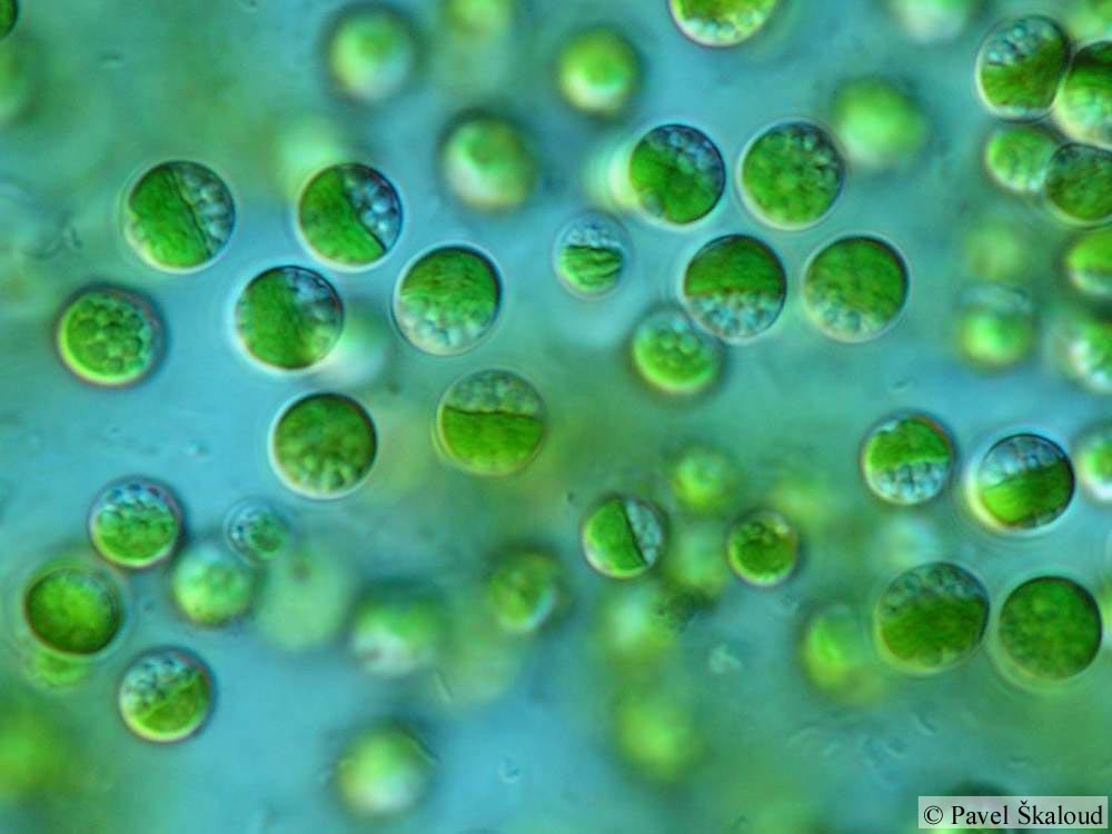 Красные водоросли клетки. Цианобактерии. Unicellular Green algae. Chlorophyceae. Chlorophyceae (Хлорофициевые) водоросли) картинки.
