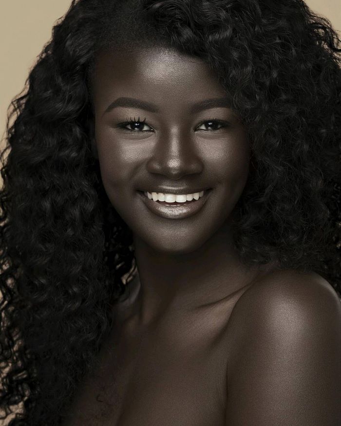 “Growing up, I faced it by confronting the bullies” - Teen Bullied For Her Incredibly Dark Skin Color Becomes A Model, Takes The Internet By Storm “Growing up, I faced it by confronting the bullies” - Teen Bullied For Her Incredibly Dark Skin Color Becomes A Model, Takes The Internet By Storm