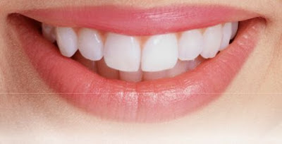 Các cách làm trắng răng tại nha khoa 