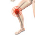 क्या आपको भी रहता है घुटनों में दर्द ? लक्षण,कारण,बचाव,इलाज ( Do you also have pain in the knees? Symptoms, causes, healing, cure) क्या आपको भी रहता है घुटनों में दर्द ? लक्षण,कारण,बचाव,इलाज ( Do you also have pain in the knees? Symptoms, causes, healing, cure)