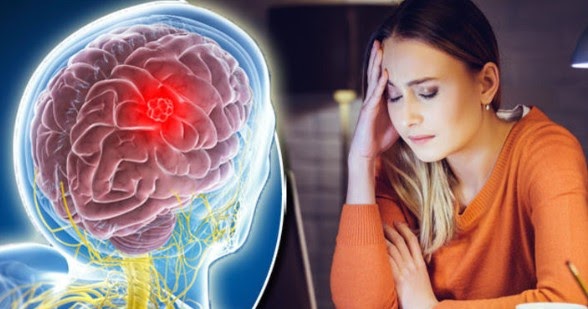 8 Signs You Had a Stroke and Might Not Know It. Try not to Ignore These ...
