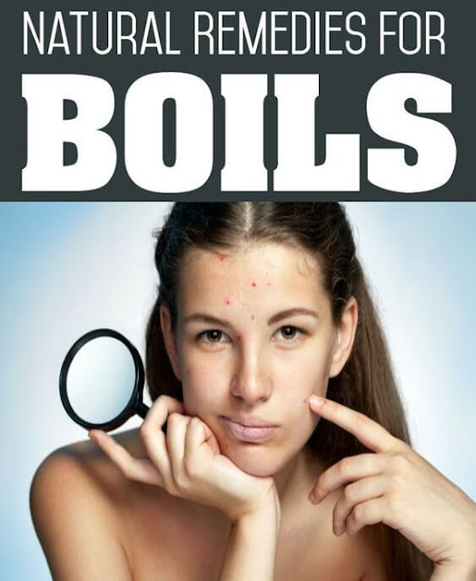 Home remedies for boils