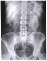 abdominal radiograph