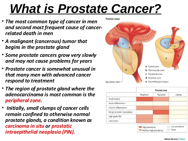 essay of prostate cancer