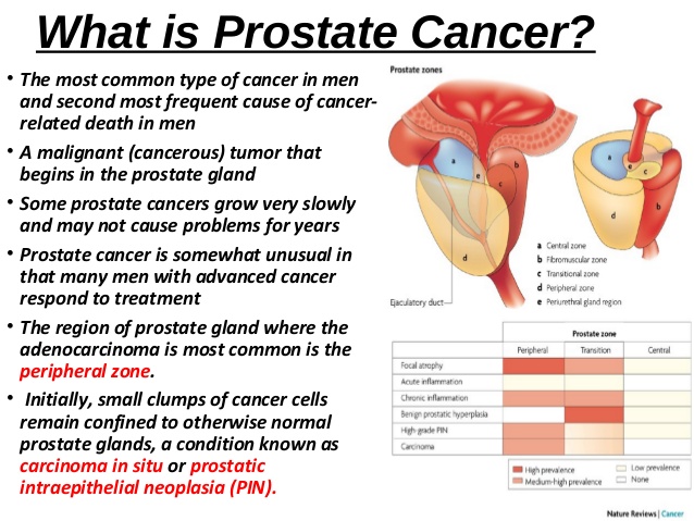 essay about prostate cancer