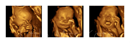 UC Baby 3-D Ultrasound Brampton