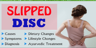 Slipped Disc: Causes, Symptoms аnd Treatments