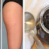 2 Ingredients Anti-Cellulite Paste! The Magic Cellulite Eraser!