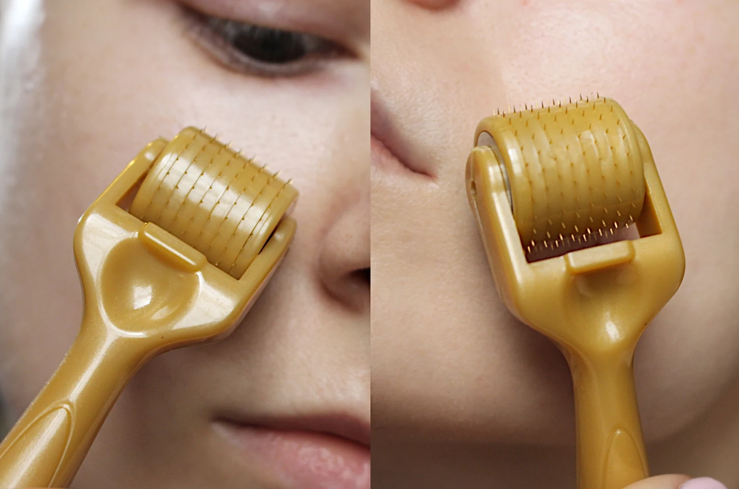 a close-up of a face skin and derma roller tool toching it