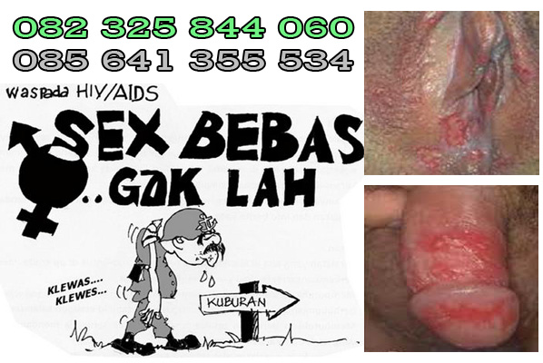 Adult sex aids costa rica