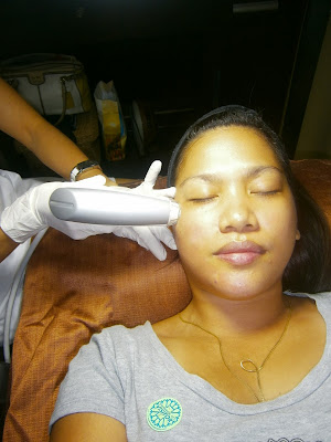 eMatrix Sublative Rejuvenation Treatment