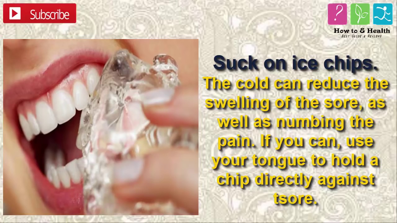 Singaw Sign Singaw English Term – Canker Sores: Causes, Symptoms, Treatments, and ...