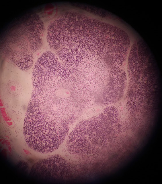 histology slide of thymus