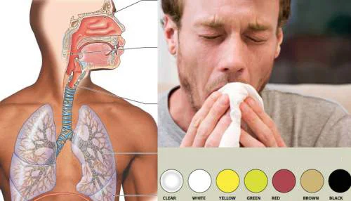 Types de mucus: Ce que dit la couleur de votre mucus au sujet de votre santé