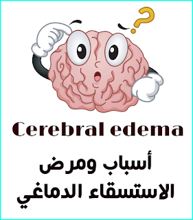 Cerebral edema