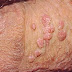 Cara Penyembuhan Virus Hepatitis B thumbnail
