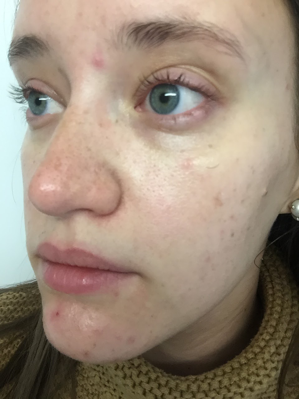 My Skincare Story and Current Routine Connecticut Fashion and