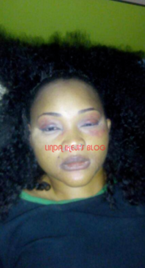 5 LIB Exclusive: Mercy Aigbe's 7-year marriage to Lanre Gentry crashes over alleged battering. See her battered face (photos)