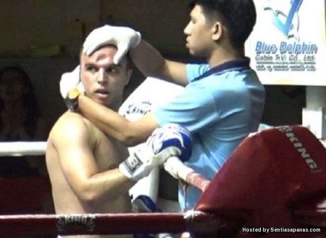Dahi Peninju Muay Thai Retak Selepas Terkena Serangan Siku!