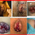 Obat Wasir Selain Venaron Resep Dokter thumbnail