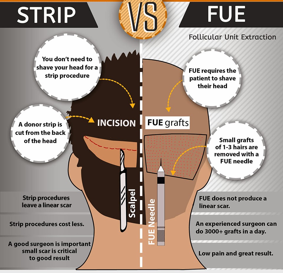 FUE Hair Transplant by MediHair Hair Transplant Melbourne Hair