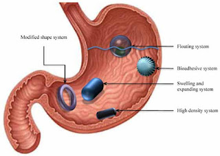 Faktor yang Mempengaruhi Bioavailabilitas Obat