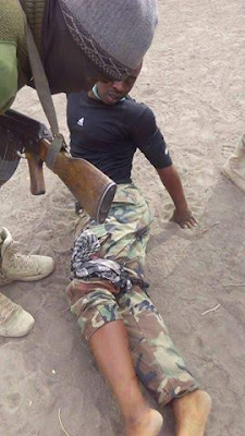y Photos: Nigerian Soldier shot in the leg during gun battle with Boko Haram in neighbouring Cameroon