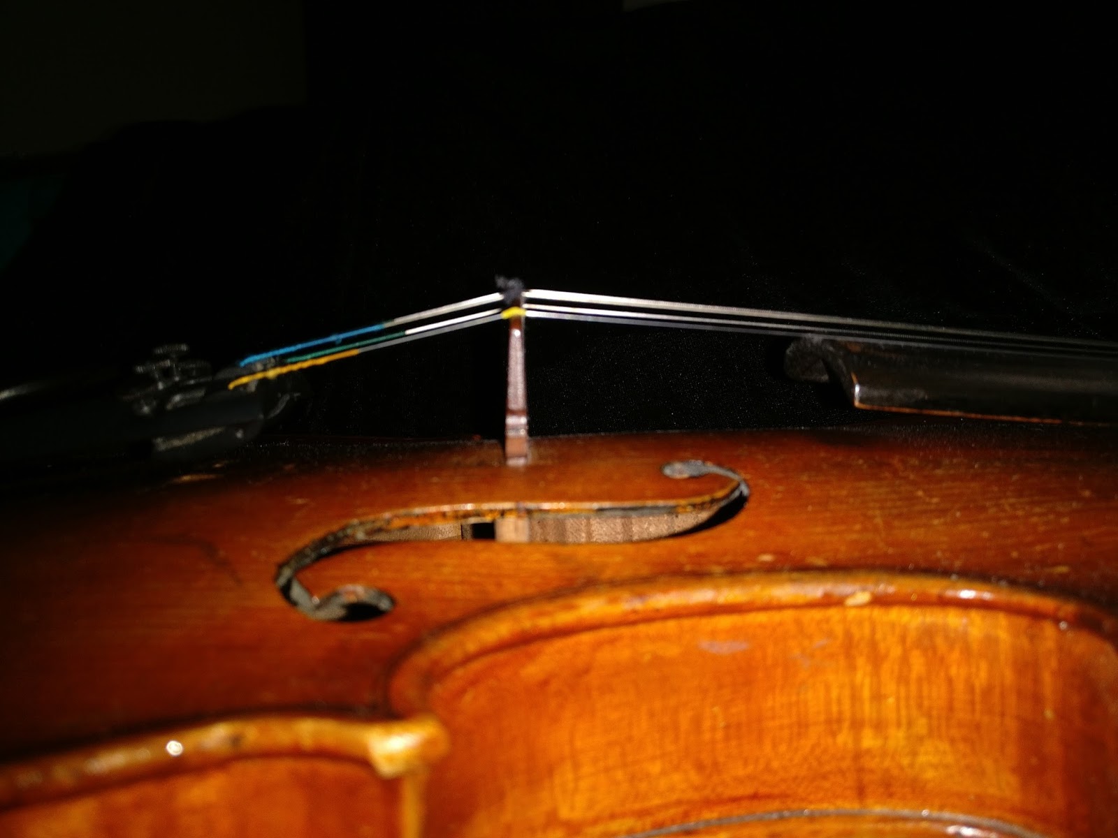 Lap Surgeon VIOLIN MATTERS THE SOUND POST