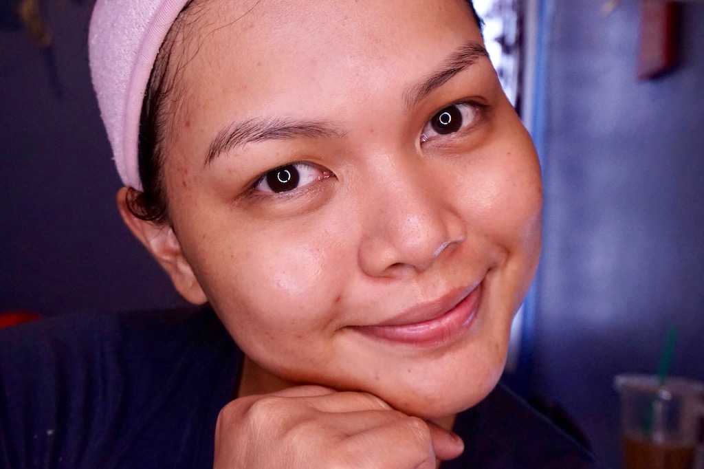 New Effective AntiAcne Skin Care Discovery Skin Life Medicated Acne