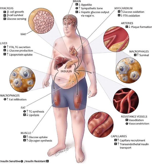 Penyakit diabetes melitus