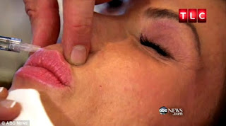 Frances Marques getting a botox injection on Plastic Wives