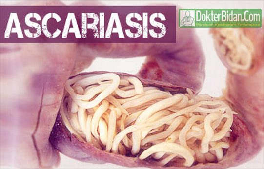 Ascariasis Cacing Gelang - Tanda Gejala Penyebab Penularan Dan Cara Mengobatinya Ascariasis Cacing Gelang - Tanda Gejala Penyebab Penularan Dan Cara Mengobatinya