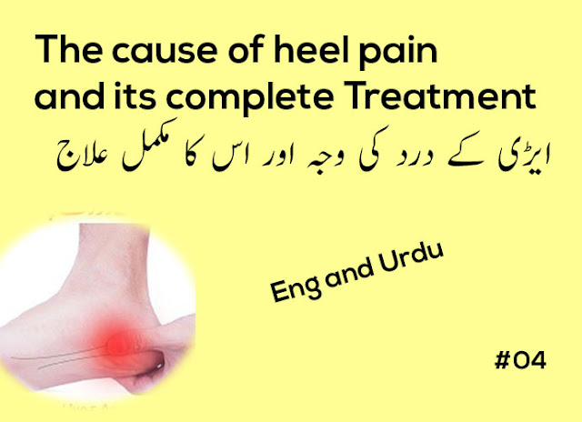 heel pain treatment in urdu