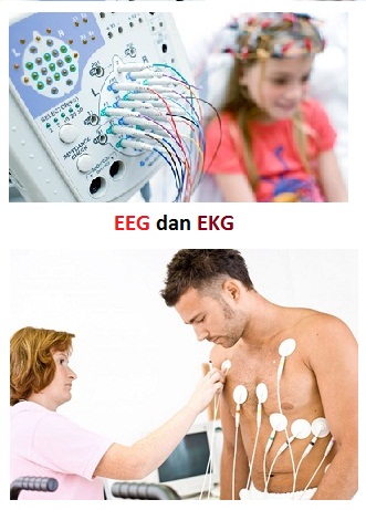 Perbedaan EEG dan EKG