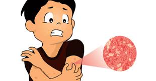 Obat Nyeri Dan Luka Pada Kelamin Obat Nyeri Dan Luka Pada Kelamin