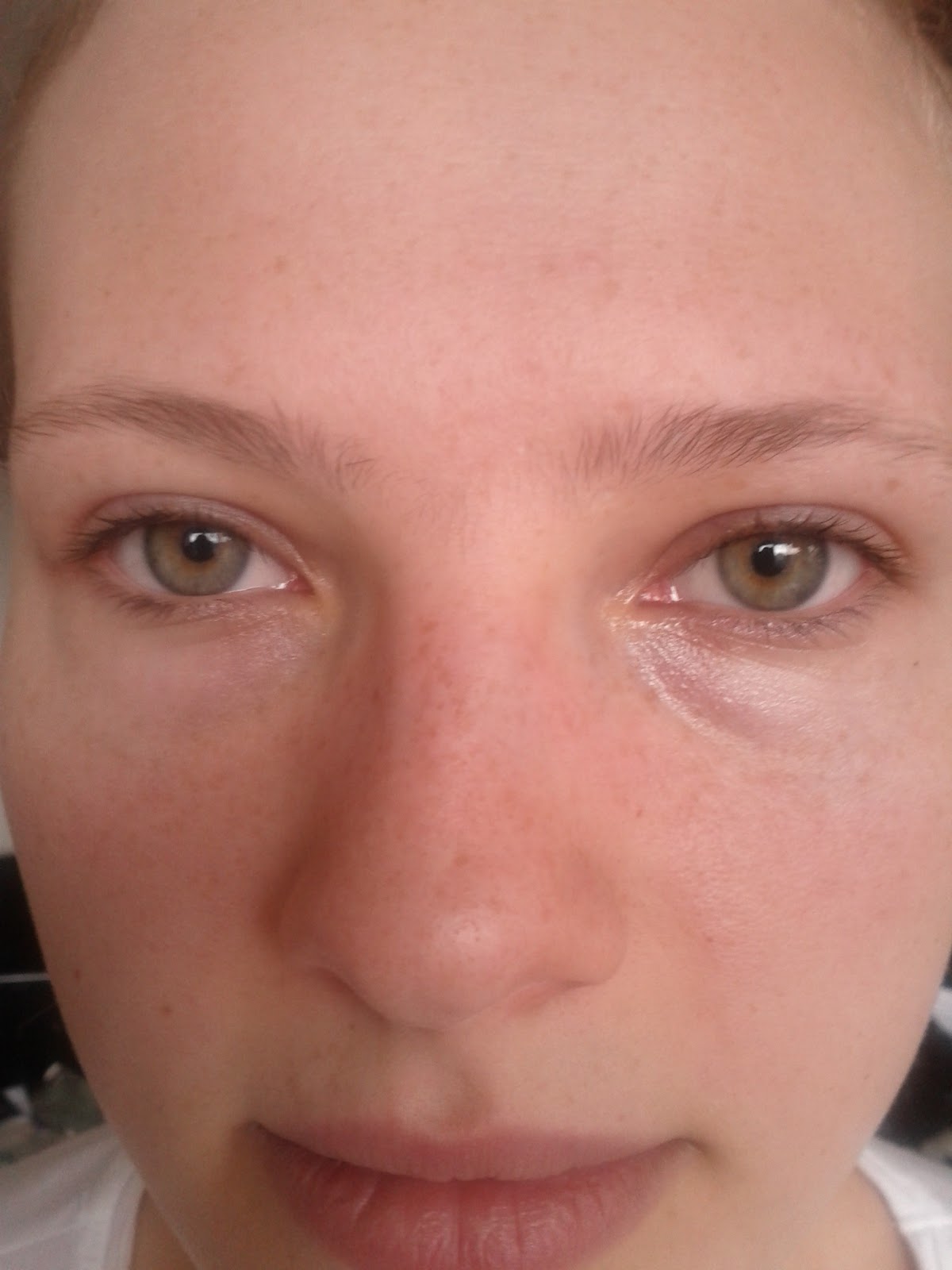 preparation h cream under eyes