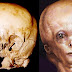 El misterio detrás del cráneo del Starchild ¿Los restos de un antiguo extraterrestre?