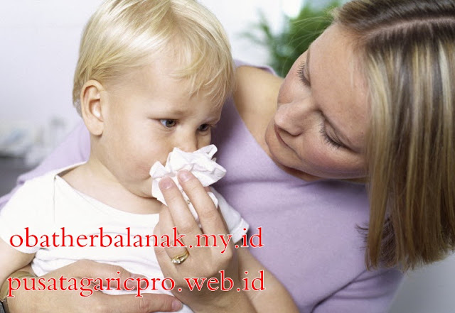 Cara Mengatasi Sinusitis Secara Aman dan Efektif Cara Mengatasi Sinusitis Secara Aman dan Efektif