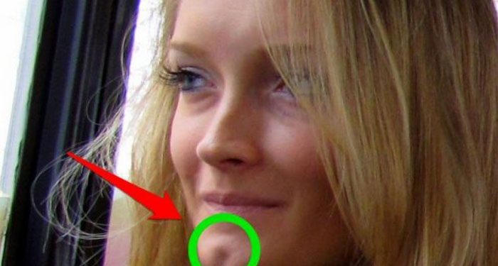  If You Have This Hole On Your Chin You Are Really Special! 