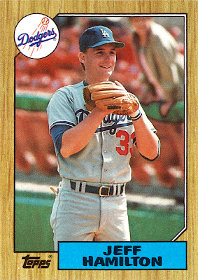 Top of the Topps: 1987 Topps: Part III
