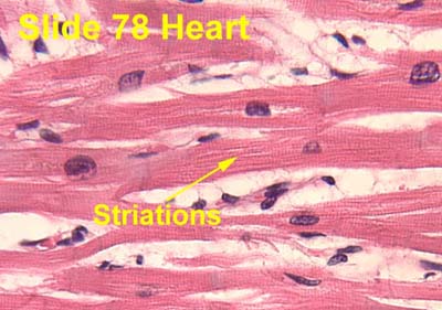 HISTOLOGY PICTURES: Muscle