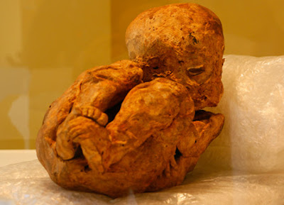 Museu Egípcio e Rosacruz de Curitiba: múmia andina