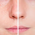Using Ultra Dark Tanning Lotion To Attain A Deeper Bronze Skin Color