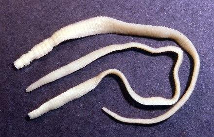 Bahaya Cacing Pita Pada Manusia